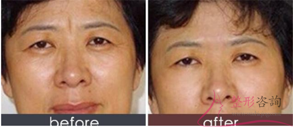 1655195281 1655195281