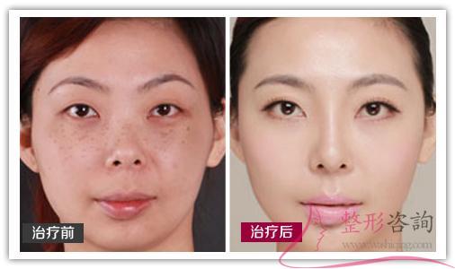 1657247881 1657247881