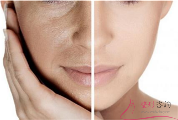 1705576994 1705576994