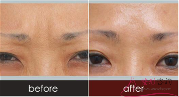 1719219010 1719219010