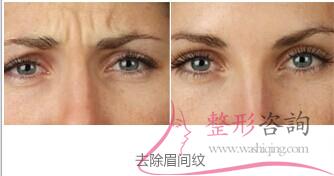 1833255132 1833255132