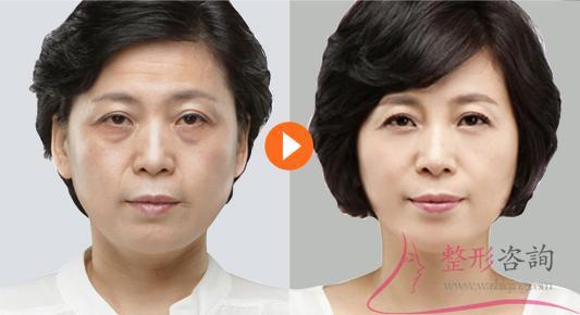 2043442090 2043442090