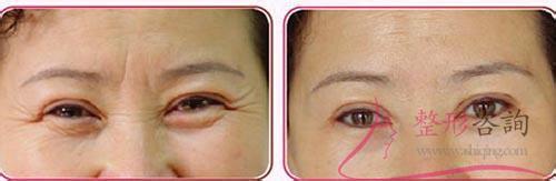 2057083292 2057083292