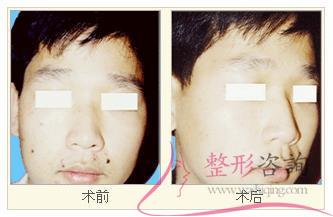 2245198121 2245198121