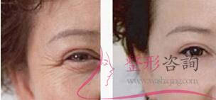 1551405648 1551405648