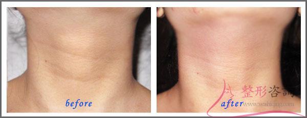 1925296869 1925296869