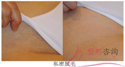 2017044192 2017044192