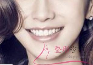 0819252633 0819252633