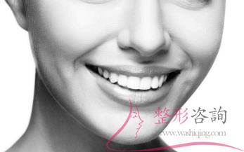 0819502214 0819502214