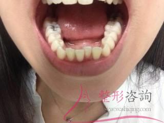 0938083704 0938083704