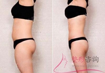 1116263101 1116263101