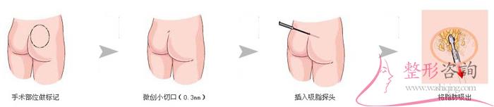 1506147755 1506147755