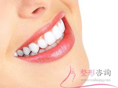 2344333578 2344333578