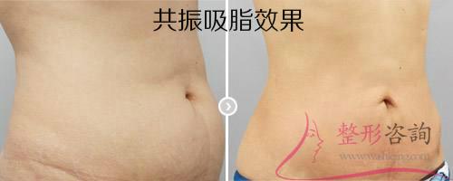 1134405178 1134405178