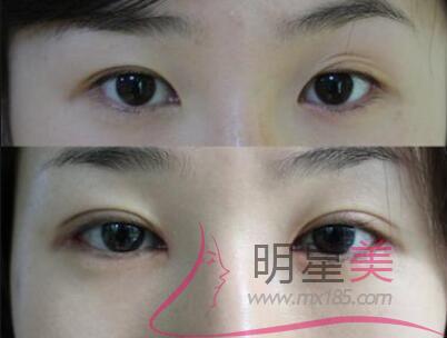 涂什么可以長眉毛