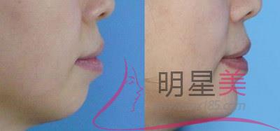 網紅臉vs高級臉