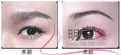 成都<a href=http://m.f3bb6.cn/listinfo-657-0.html target=_blank class=infotextkey>繡眉</a>哪里比較好