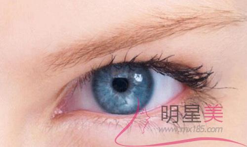 怎么調理臉部暗黃