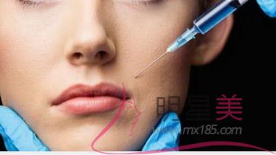 整容削臉骨多少錢