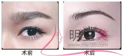 紋眉多久可以洗