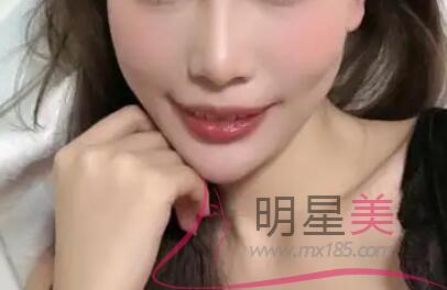 臉上長小紅疙瘩帶白頭