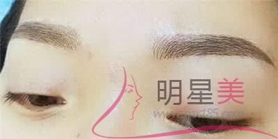 紋眉后能吃辣嗎