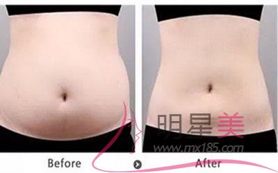 按摩<a href=http://m.f3bb6.cn/listinfo-631-0.html target=_blank class=infotextkey>瘦臉</a>的方法