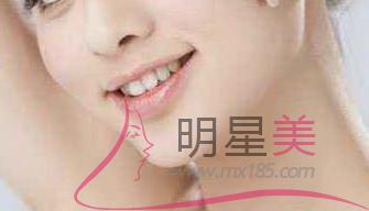 假體墊下巴后有增生