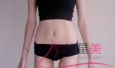 沈陽埋線<a href=http://m.f3bb6.cn/listinfo-687-0.html target=_blank class=infotextkey>減肥</a>瘦身