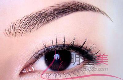 惠州提眉<a href=http://m.f3bb6.cn/listinfo-655-0.html target=_blank class=infotextkey>切眉</a>手術