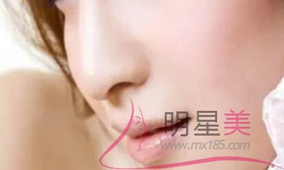 額頭上的痣去掉會(huì)影響運(yùn)勢(shì)嗎