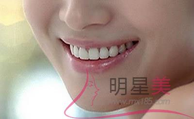 怎么治療面部下垂