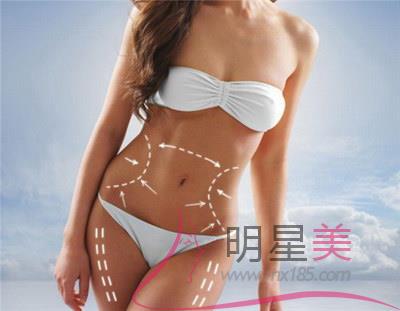 抽脂后恢復期多久