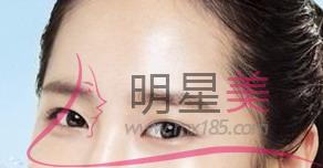 人造酒窩的危害