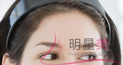 怎么樣讓額頭變高