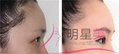 懷孕能刮眉毛嗎