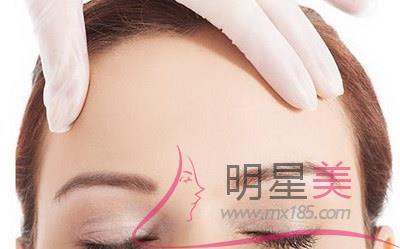 人造酒窩有哪些