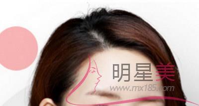 臉上有白白的一小粒東西是什么圖片