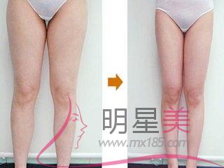 最有效<a href=http://m.f3bb6.cn/listinfo-684-0.html target=_blank class=infotextkey>瘦大腿</a>內側