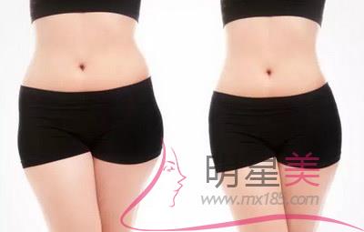 打<a href=http://m.f3bb6.cn/listinfo-631-0.html target=_blank class=infotextkey>瘦臉</a>針臉會腫多久