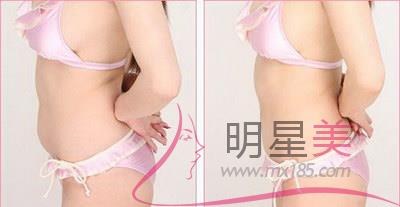 哪家超聲<a href=http://m.f3bb6.cn/listinfo-682-0.html target=_blank class=infotextkey>溶脂</a>好