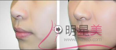 <a href=http://m.f3bb6.cn/listinfo-643-0.html target=_blank class=infotextkey>豐額頭</a>用什么材料