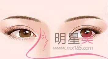 煤炭總醫院整形紋眉