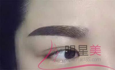 紋眉后曬太陽有影響嗎