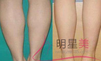 白醋泡姜能<a href=http://m.f3bb6.cn/listinfo-687-0.html target=_blank class=infotextkey>減肥</a>嗎