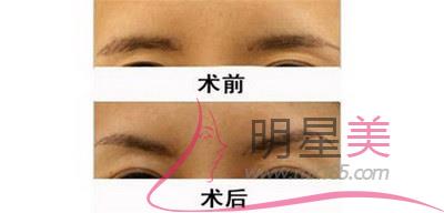 來例假第四天可以紋眉毛嗎