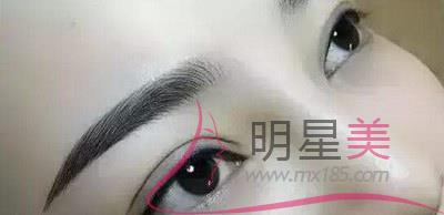 紋眉組織液是什么