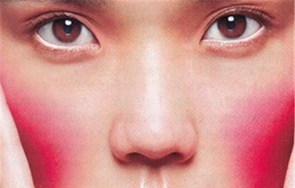 做<a href=http://m.f3bb6.cn/listinfo-772-0.html target=_blank class=infotextkey>去紅血絲</a>失敗修復不適應人群有哪些