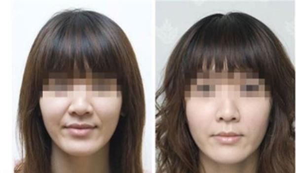 做<a href=http://m.f3bb6.cn/listinfo-792-0.html target=_blank class=infotextkey>去法令紋</a>不適應人群有哪些