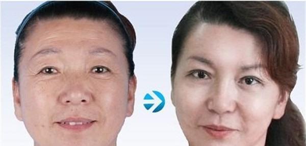 做<a href=http://m.f3bb6.cn/listinfo-731-0.html target=_blank class=infotextkey>玻尿酸</a><a href=http://m.f3bb6.cn/listinfo-765-0.html target=_blank class=infotextkey>去抬頭紋</a>價(jià)格